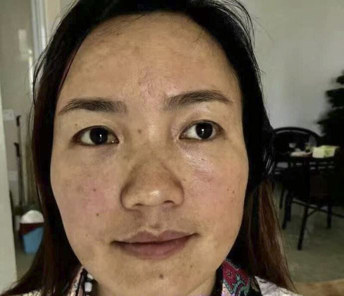 斑相女人脸部痣相图解_脸上长斑的祛斑方法脸部祛斑_斑美拉脸部排毒的危害