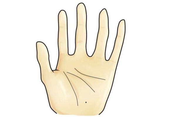 手掌的痣代表着哪些位置和命运什么样的联系？