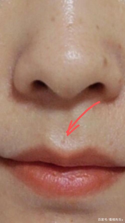 （李向东）面相看你是否有直纹竖纹？
