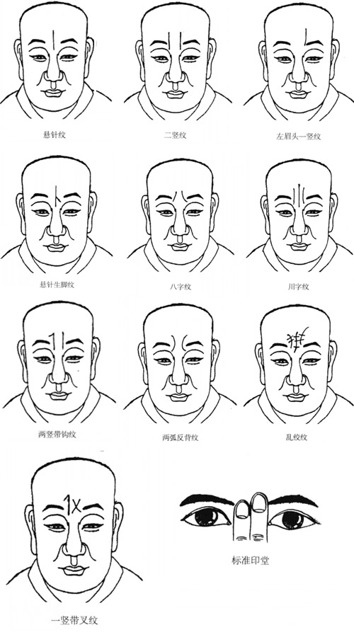 风水堂:印堂有竖纹面相图解